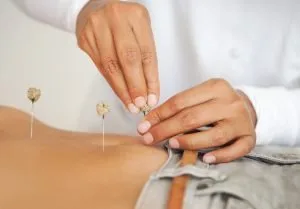 acupuncture Orlando helps