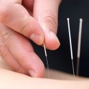Orlando Acupuncture